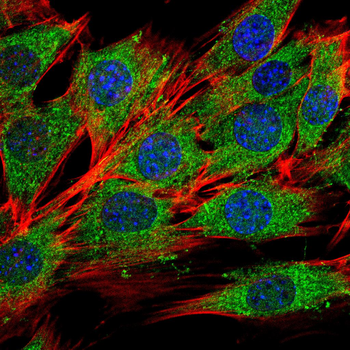 CYP11A1 Antibody