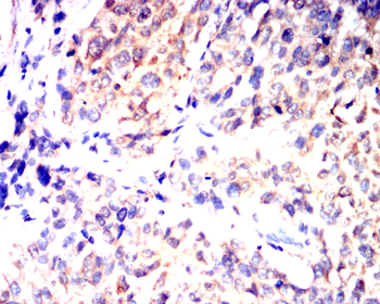 BAD Antibody