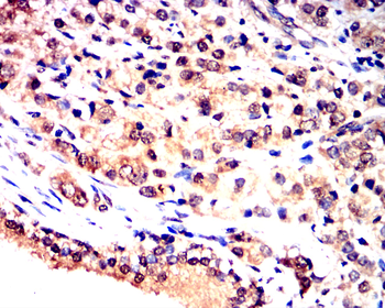 BAD Antibody