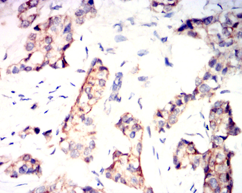 KRT19 Antibody