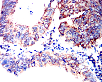 CYP19A1 Antibody