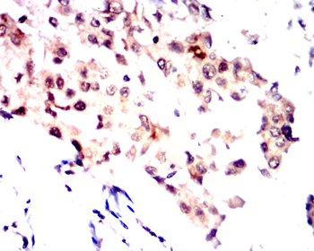 RELA Antibody