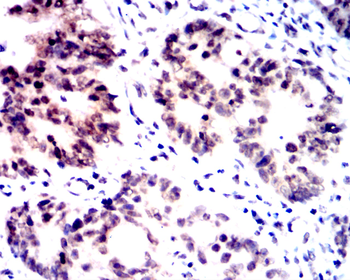 RELA Antibody