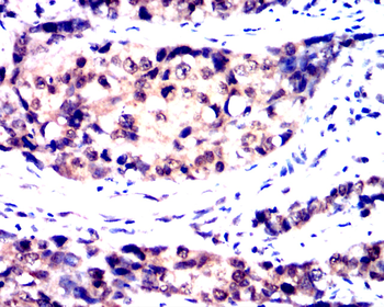 RELA Antibody