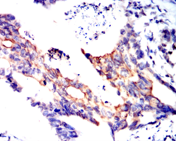 KRT19 Antibody