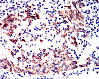 KRT19 Antibody