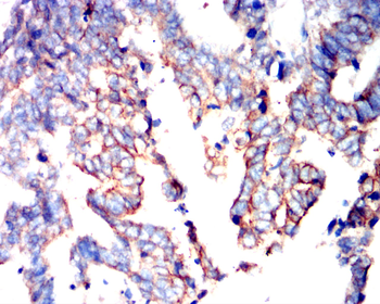 KRT19 Antibody