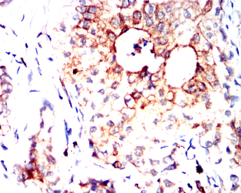 CLDN2 Antibody