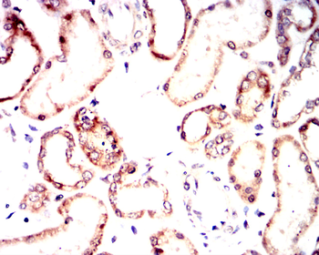 CLDN2 Antibody