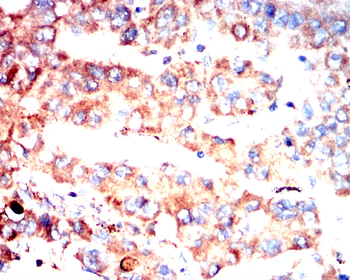 CLDN2 Antibody