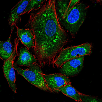 FOXO1 Antibody