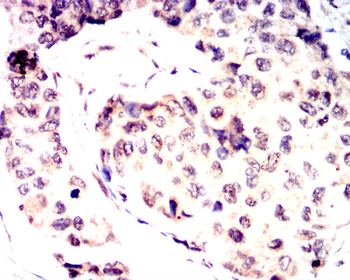 FOXO1 Antibody
