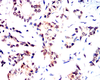 FOXO1 Antibody