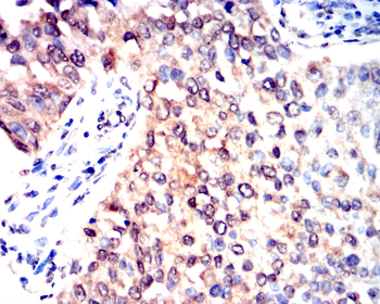 FOXO1 Antibody
