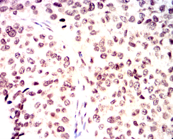 FOXO1 Antibody