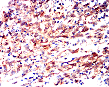 FOXO1 Antibody