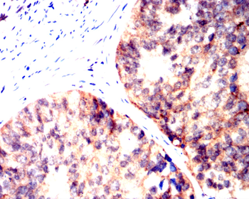 FAS Antibody