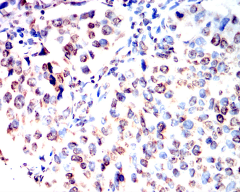 CCNB1 Antibody