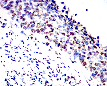 CCNB1 Antibody
