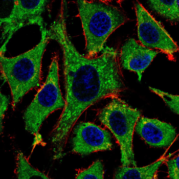S100A8 Antibody