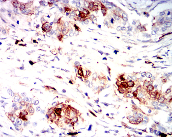 S100A8 Antibody