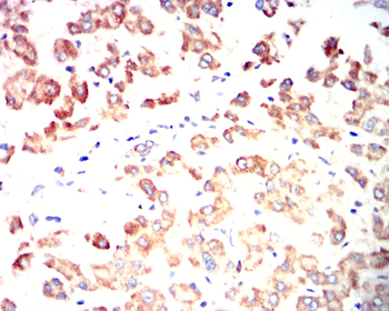 S100A8 Antibody