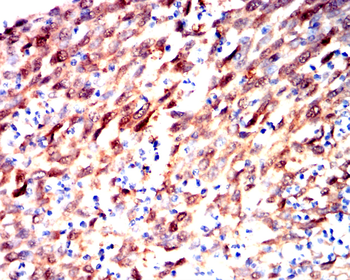 S100A8 Antibody