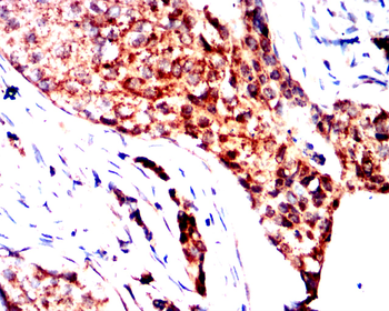FGFR3 Antibody