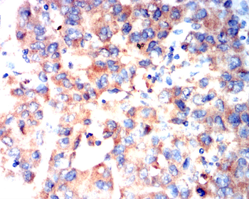 FGFR3 Antibody