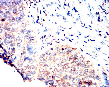 FGFR3 Antibody