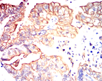 FGFR3 Antibody