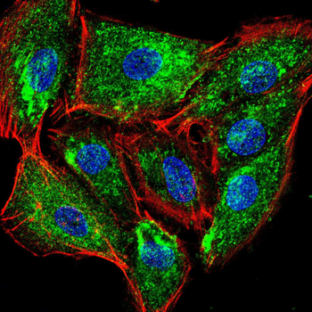 SENP1 Antibody