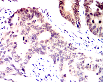 SENP1 Antibody
