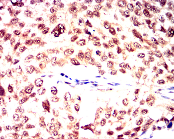 SENP1 Antibody