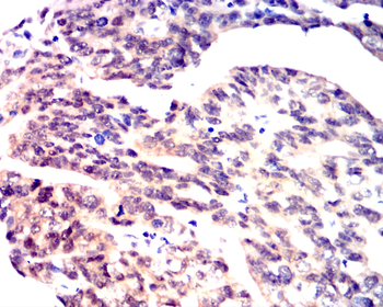 SENP1 Antibody