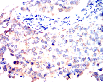 FAP Antibody