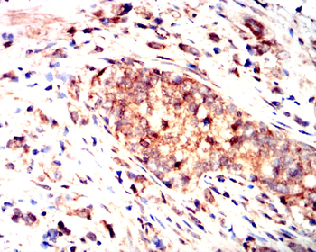 IL5 Antibody
