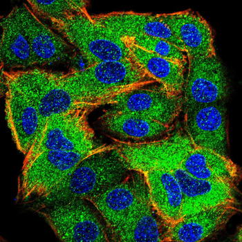 HSPB1 Antibody