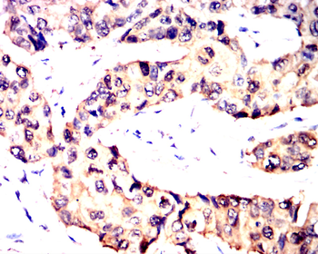 HSPB1 Antibody
