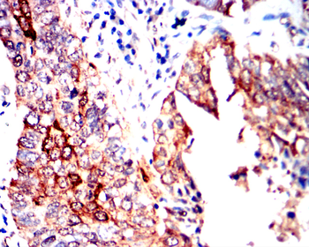 HSPB1 Antibody