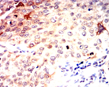 HSPB1 Antibody