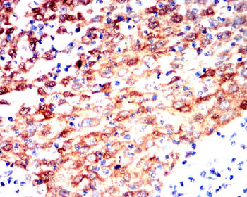 HSPB1 Antibody