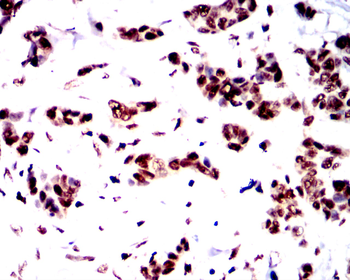 FGFR1 Antibody
