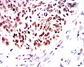 FGFR1 Antibody