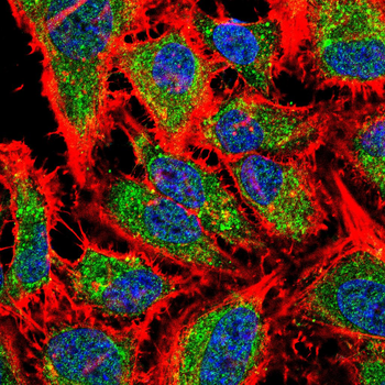 PRKCA Antibody