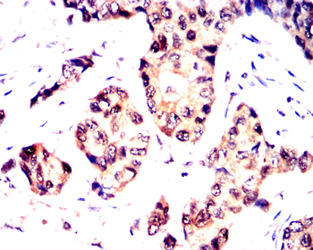 PRKCA Antibody