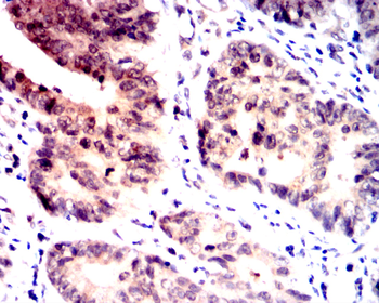 PRKCA Antibody