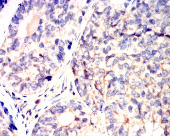 PRKCA Antibody