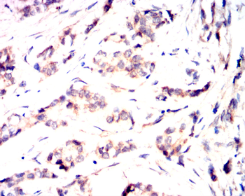 PRKCD Antibody