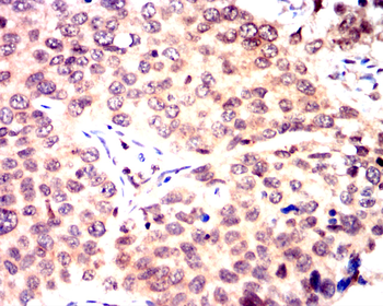 PRKCD Antibody
